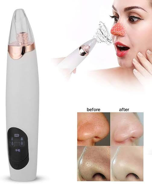 BlackHead Removal Machine