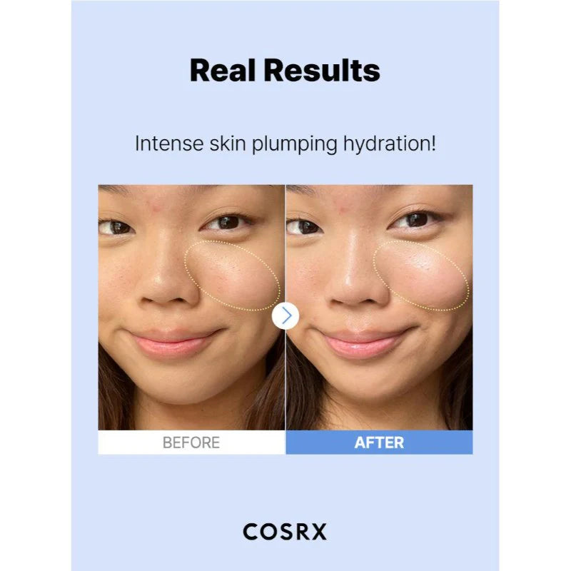 COSRX Hyaluronic acid serum